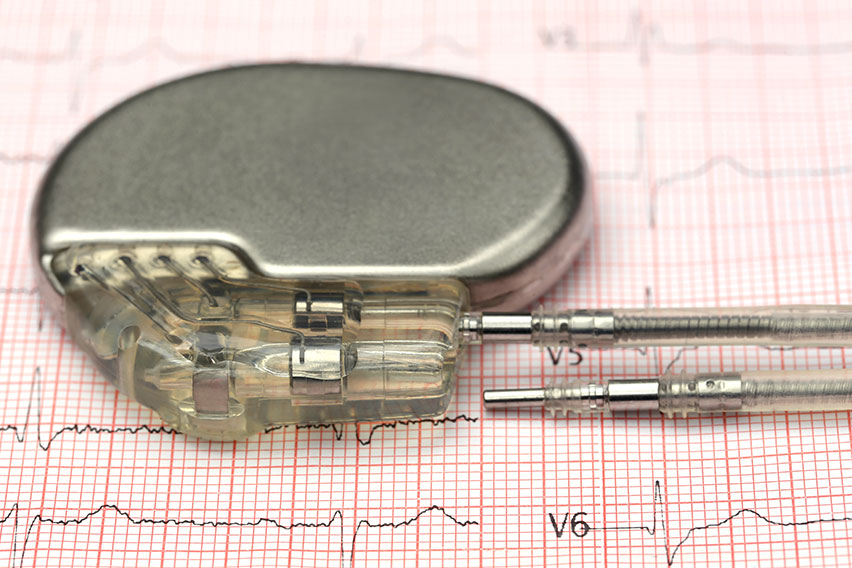 Pacemaker